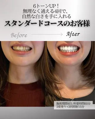 歯科提携エラン ホワイトニング一社店のその他イメージ