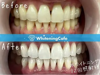 ホワイトニングカフェ 荻窪店のその他イメージ