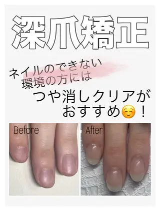 ネイル nail salon petillantのネイルデザイン