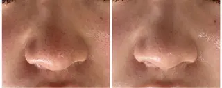 COCO beautyサロンのエステ・リラクイメージ