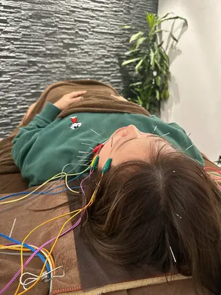 小顔矯/美容鍼/鍼灸 BeauJuのその他イメージ