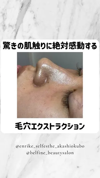 夕希 毛穴と脱毛特化サロンのエステ・リラクイメージ