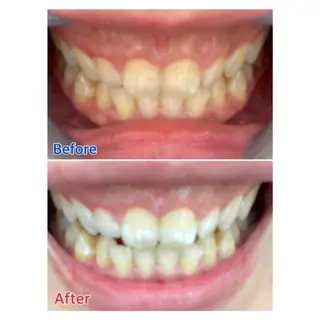 M渋谷 セルフホワイトニングのエステ・リラクイメージ