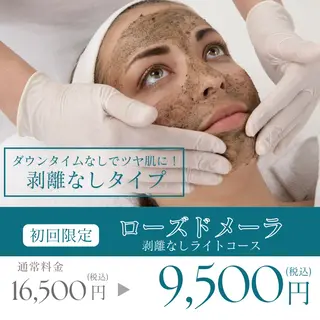 肌質改善ピーリング ✧BestBelleのエステ・リラクイメージ