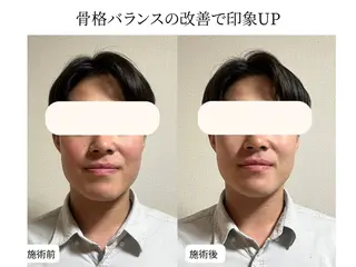 小顔矯正×毛穴サロン DRRAMSPA町田のエステ・リラクイメージ
