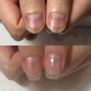 ネイル 自爪育成・巻き爪 補正講師 津蔵のネイルデザイン