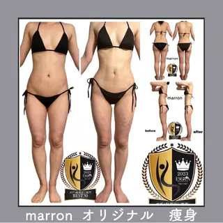 痩身ハイパーナイフ ララピールリアボーテのエステ・リラクイメージ