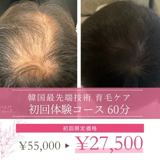 ショート カラー パーマ ヘアアレンジ メンズ キッズ 美肌脱毛エステサロン Luangeのエステ・リラクイメージ