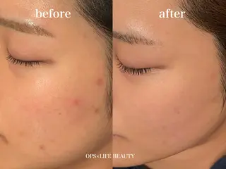 OPS×LIFE BEAUTY/maiのエステ・リラクイメージ