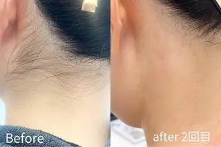 Balance facialのエステ・リラクイメージ