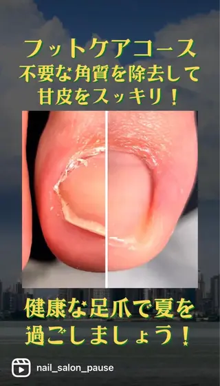 ネイル 自爪育成ネイルサロン Pause(ポーズ)のネイルデザイン