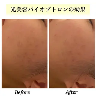 Bellesthe (ベルエステ)のエステ・リラクイメージ