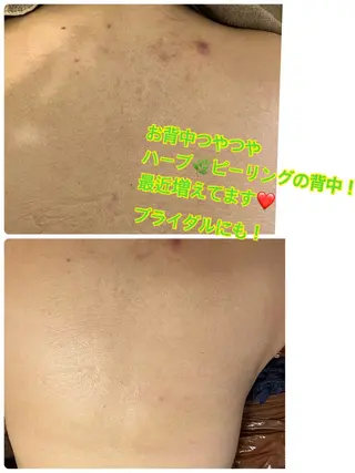 ❤️予約殺到❤️mi オールハンド痩身専門のエステ・リラクイメージ