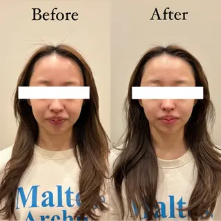 HariLounge 梅田のエステ・リラクイメージ