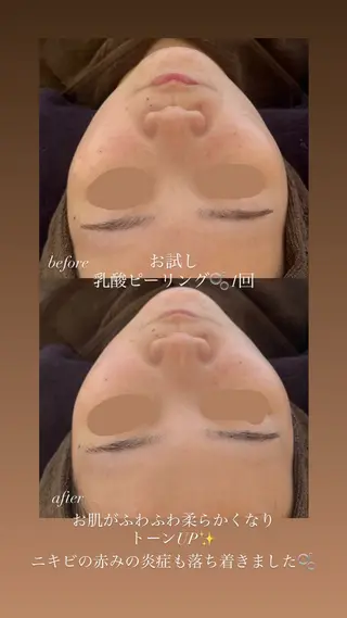 yukiko/ 垢抜け透明感hairのエステ・リラクイメージ