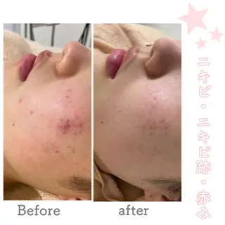ミディアム カラー パーマ ヘアアレンジ メンズ ネイル マツエク・マツパ ニキビ&跡改善サロン オーナー光木のエステ・リラクイメージ