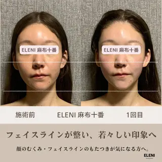 麻布十番小顔コルギ 姿勢矯正リアン💗のエステ・リラクイメージ