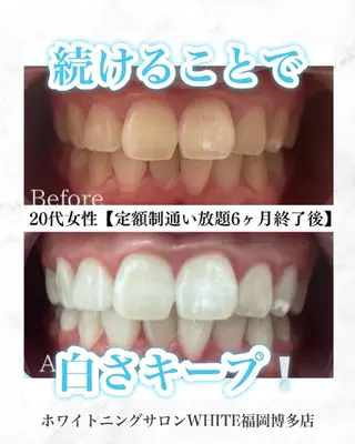 メンズ キッズ セルフホワイトニング WHITE福岡博多店のエステ・リラクイメージ