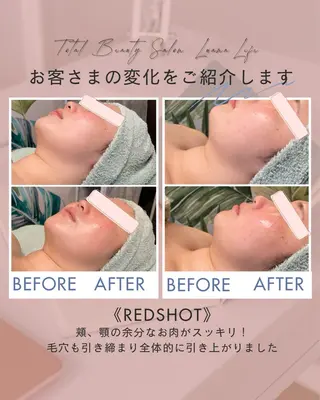 肌改善・脱毛・痩身 LuanaLifeのエステ・リラクイメージ