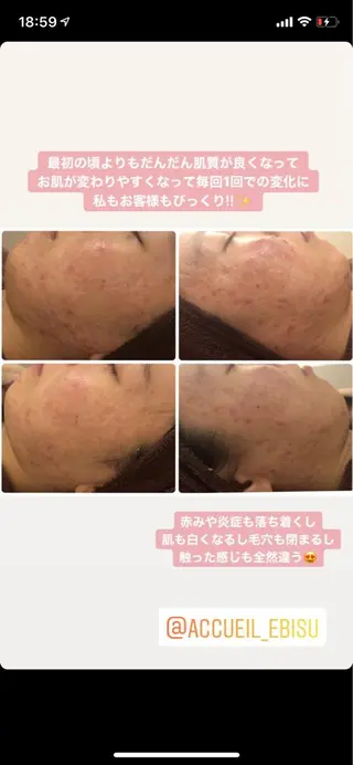 ミディアム カラー パーマ ヘアアレンジ メンズ キッズ ネイル マツエク・マツパ ニキビ・肌質改善専門 ♡人生が変わるサロンのエステ・リラクイメージ