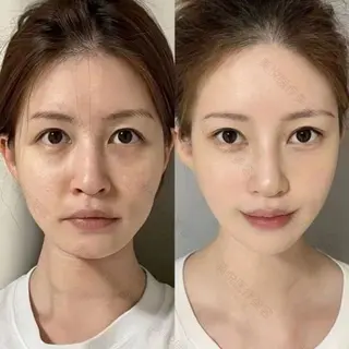 ネイル 愛維美水光専門店 川崎彩鳳のエステ・リラクイメージ