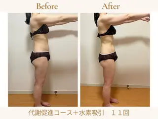 あみ|痩身の最先端 よもぎ蒸しサロン大塚のエステ・リラクイメージ