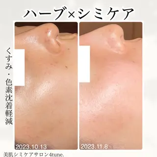 美肌シミケアサロン 4tune.RUMIのその他イメージ