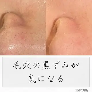 ニキビ経験者が施術 する専門サロン🌻のエステ・リラクイメージ