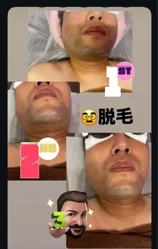 脱毛サロン マーメイドのエステ・リラクイメージ