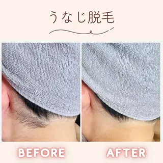 脱毛・光フェイシャル Saphirのエステ・リラクイメージ