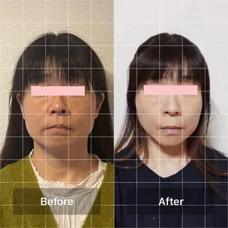小顔矯正 ラハイナのエステ・リラクイメージ