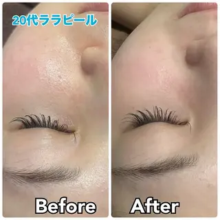 【毛穴・美白・美肌】 美・up 青葉台店のエステ・リラクイメージ