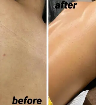 なみ|WAX脱毛専門 店|さいたま市のエステ・リラクイメージ