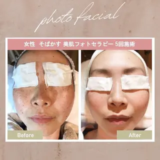 美肌脱毛i |泉大津のエステ・リラクイメージ