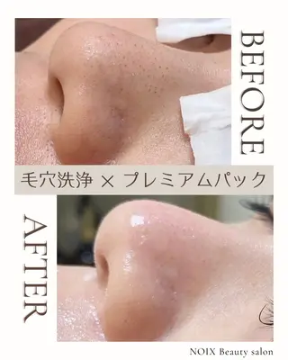 NOIXbeauty salonのエステ・リラクイメージ