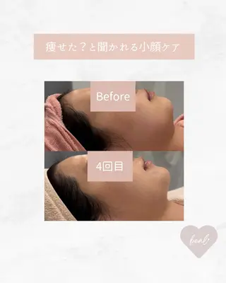 小顔/毛穴/ニキビ salon bealのエステ・リラクイメージ