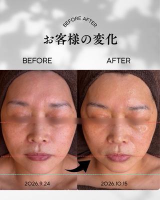 【豊明市】肌質改善 ・痩身サロンルシアのエステ・リラクイメージ