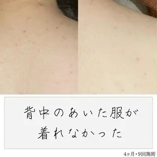 ニキビ経験者が施術 する専門サロン🌻のエステ・リラクイメージ
