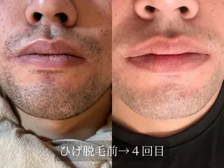 脱毛サロン Arumのエステ・リラクイメージ