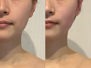 TAO エステのエステ・リラクイメージ