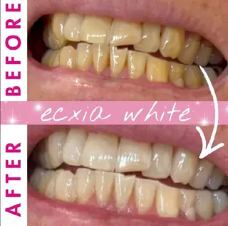 ecxiawhite 倉敷店のエステ・リラクイメージ
