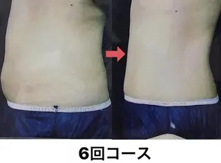 横浜エステサロン R-ing リングのエステ・リラクイメージ