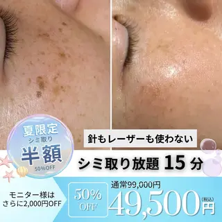 シミ・毛穴ケア専門 クロヌYUKIのエステ・リラクイメージ