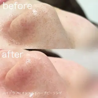 lulularico Yuのネイルデザイン