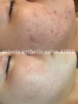 AIRIS 船橋店のエステ・リラクイメージ