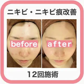ミディアム カラー パーマ ヘアアレンジ キッズ ネイル マツエク・マツパ ニキビ・肌質改善専門 ♡人生が変わるサロンのエステ・リラクイメージ