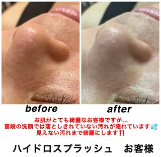 ネイル・エステサロン UILANIのエステ・リラクイメージ
