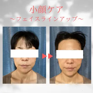 秋山 暢佑のエステ・リラクイメージ