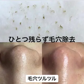 BeautyNail eyelashのネイルデザイン