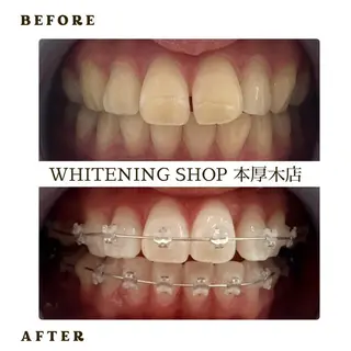 メンズ ホワイトニング ショップ本厚木のその他イメージ